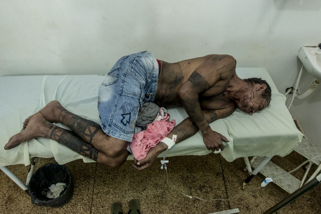 Índio Gamela, Francisco Jansen Mendonça da Luz, ferido em ataque de pistoleiros no Maranhão (Foto: Ana Mendes/CIMI)