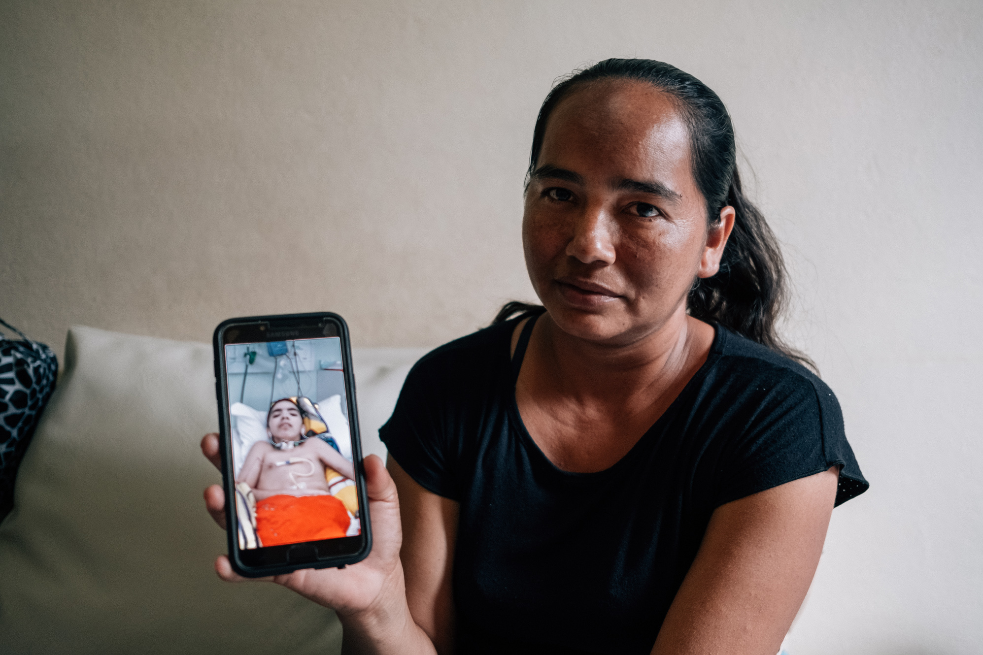 Único sobrevivente de raiva humana no Amazonas é transferido para enfermaria